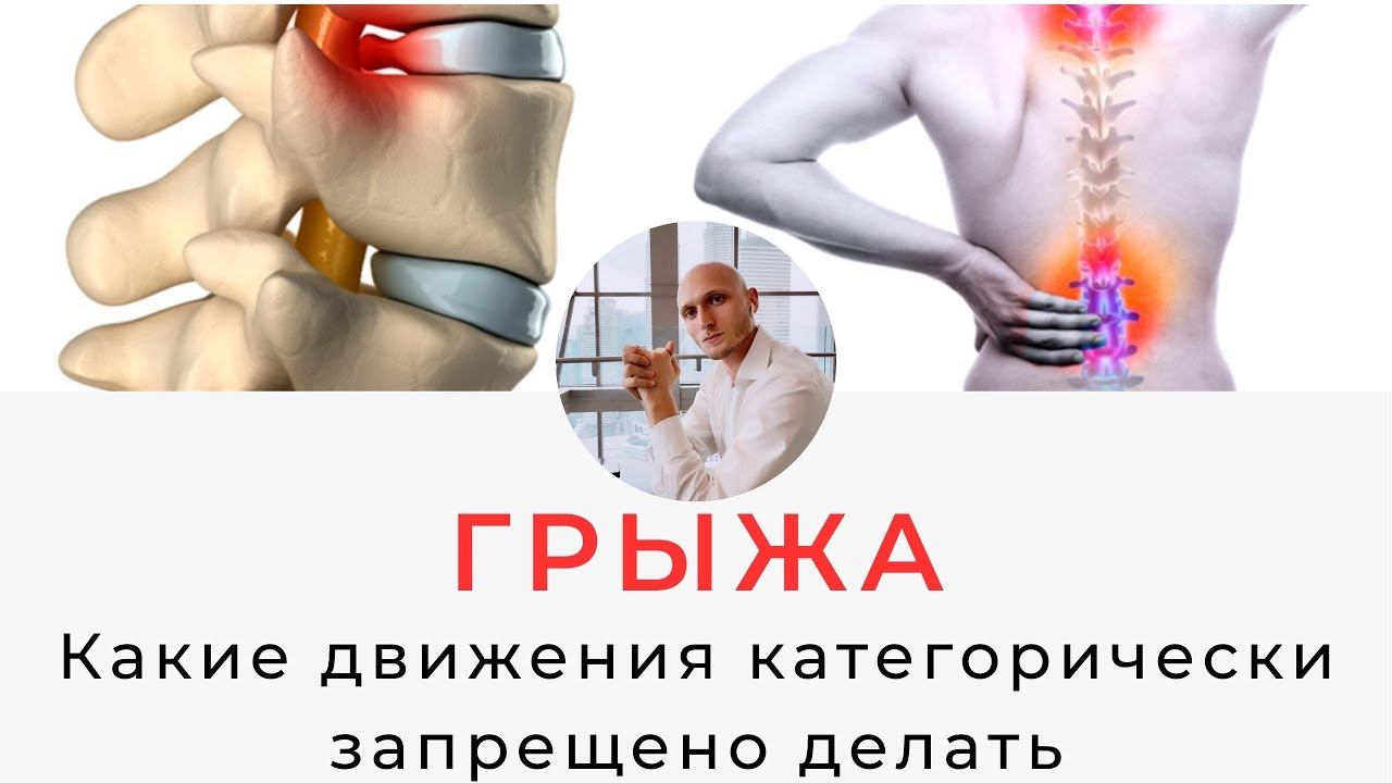 Грыжи поясницы. Какие движения категорически запрещено делать. Реабилитолог Павел Артемьев.