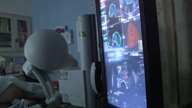 Understanding the Value of PSA Testing for Prostate Cancer Detection