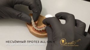 All on 4 Протез