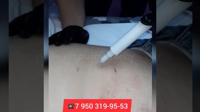 ХОЛОДНАЯ ПЛАЗМА,  ОБУЧЕНИЕ, НАБЕРЕЖНЫЕ ЧЕЛНЫ.
