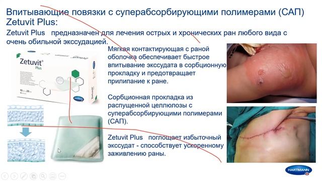 V_16.10.2020_Уход за раной_Пауль Хартман