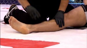 Тяжелейшая травма Анте Делия на турнире M-1 Challenge 61