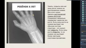 Как увеличить рост взрослого, ребенка и подростка