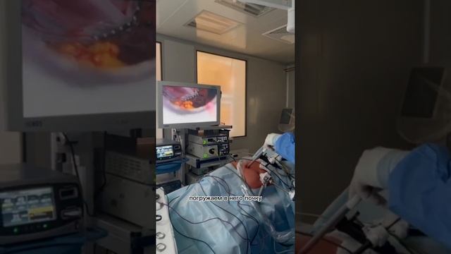 Лапароскопическая нефрэктомия: репортаж из операционной смотреть онлайн