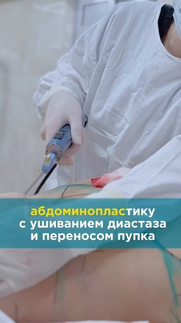 Результат абдоминопластики спустя 1,5 месяца 😍😍😍 смотреть онлайн