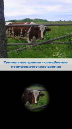 Пропало боковое зрение? Что делать?