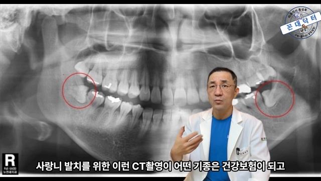 완전 매복 사랑니 수술 발치에 임하는 치과의사의 자세 #사랑니 #사랑니발치 #사랑니수술 #치과의사 #치과치료