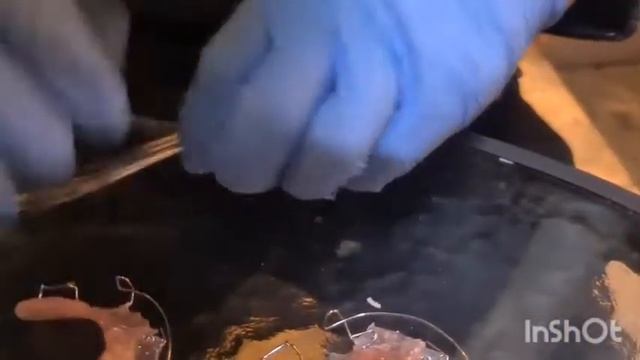 Aktivasi 6 ortho lepasan смотреть онлайн