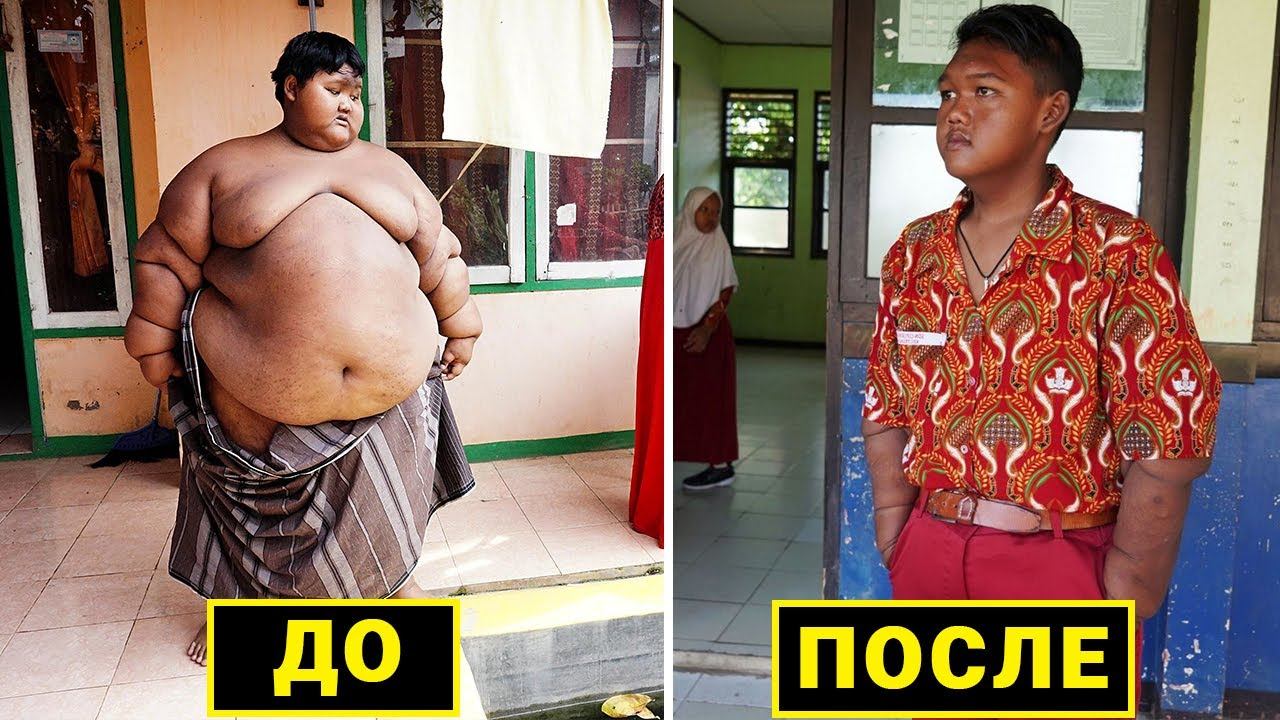 Этого мальчика называли самым толстым ребёнком в мире, но только посмотрите как он выглядит сейчас! смотреть онлайн