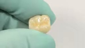 RelyX™ Unicem 2 Automix - 3M ESPE [CIMENTOS]