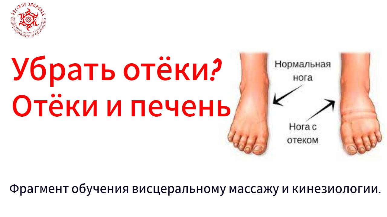Убрать отёки?  Отёки и печень. Фрагмент обучения висцеральному массажу и кинезиологии.