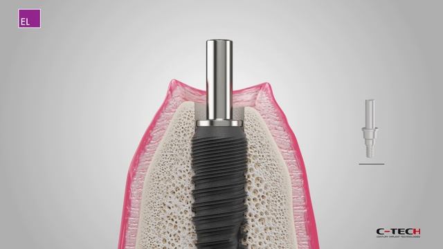 Bone Profiler смотреть онлайн