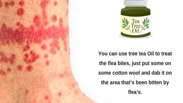UK - Flea Bites on Humans Get Rid of Fleas Pest Control, Fumigate