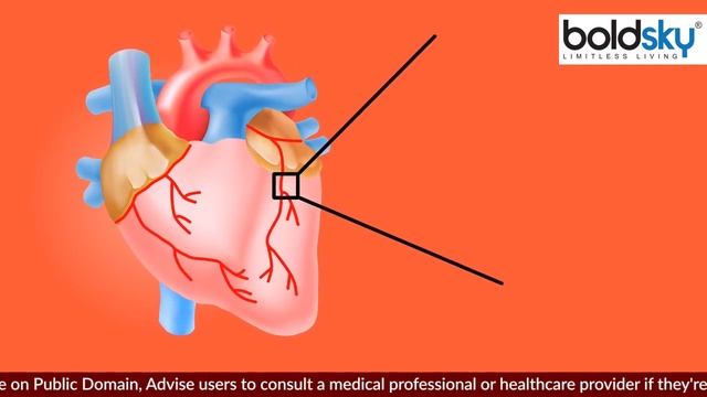 Diabetes में भुना चना खाने से क्या होता हैं | डायबटीज में भुना चना खाने के फायदे | Boldsky смотреть онлайн