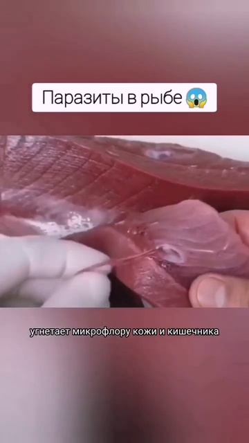 #паразиты #антипаразитарка #глисты #тригельм