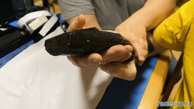 Антиспастический сплинт из термопластика. Основные этапы изготовления.