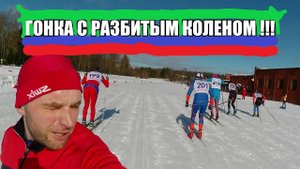 Лыжная гонка с разбитым коленом !!!