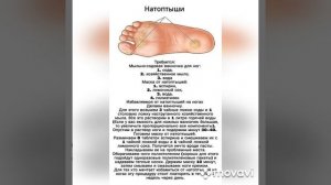Натоптыши.