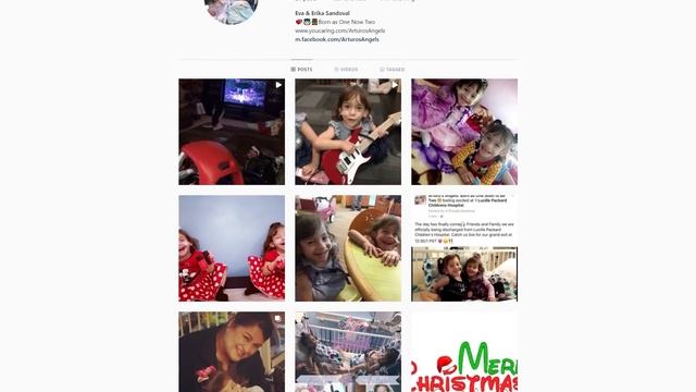 Herinner je je Deze Siamese Tweelingen? Wacht tot Je Ziet Hoe ze er NU Uitzien! смотреть онлайн