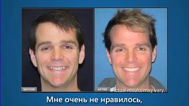 Инвизилайн смотреть онлайн