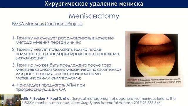 Остеоартрит коленного сустава.