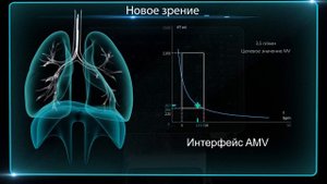 COMEN V8 аппарат ИВЛ высокого класса