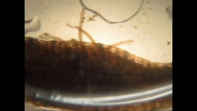 WILDLIFE_INVERTEBRATE_LEECH PARENTAL CARE смотреть онлайн