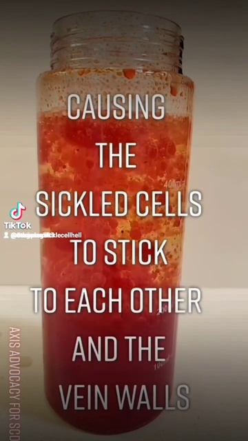 This Is Sickle Cell смотреть онлайн