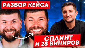 Разбор кейса тотальной реконструкции улыбки керамическими реставрациями.