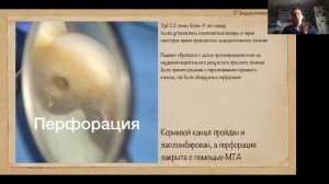 ЭНДОДОНТИЯ ДЛЯ НАЧИНАЮЩИХ. ЧАСТЬ 1
БЕСПЛАТНЫЙ ВЕБИНАР