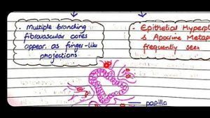 Proliferative Disease; Benign Epithelial Changes | Breast Pathology