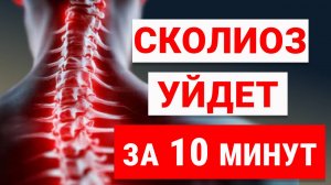 Исправить сколиоз ЛЕГКО! Лучший Комплекс упражнений для ВСЕХ