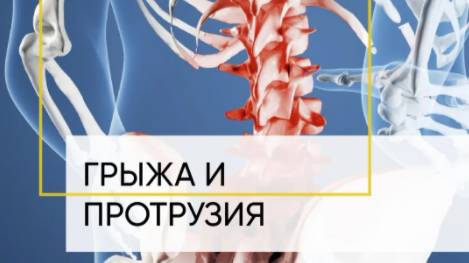 протрузии и грыжи