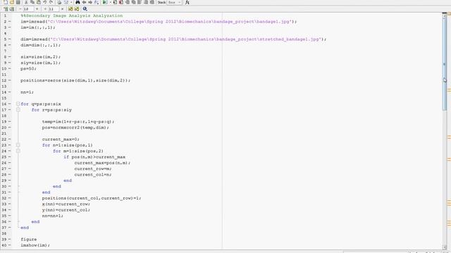 Biomechanics Image Analysis смотреть онлайн