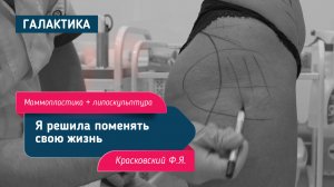Вторичная маммопластика + липоскульптура | Красковский Федор Янович