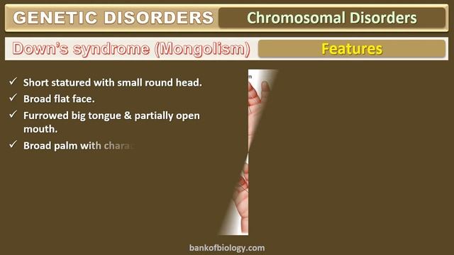 Principles of inheritance and variation -  Part 9 Genetic disorders Chromosomal disorders
