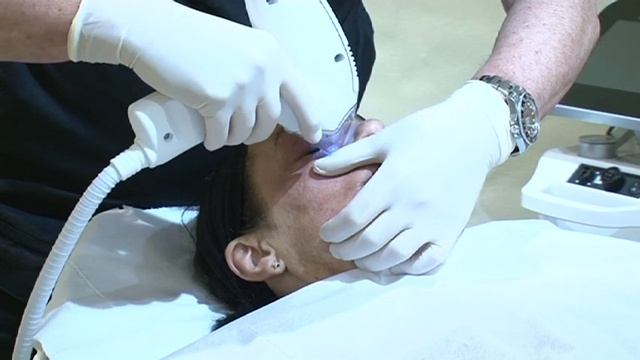 Tanis has a Tixel /Mezotix Treatment