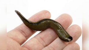 КИСТА МИЙОМА ВА БОШКА КАССАЛЛАРНИ ЗУЛУК БИЛАН ДАВОЛАШ ЙОЛИЛАР