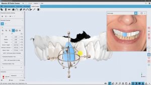 Maestro 3D | Dental Studio | Smile Creator | Digital Mockup | 3D Denture Guide