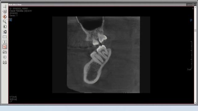 Ez3D Plus: "Utilization of Basic Function". смотреть онлайн