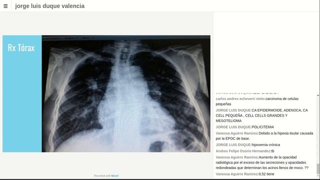 PROCESO DIAGNÓSTICO CASO DISNEA CRONICA AGUDIZADA смотреть онлайн