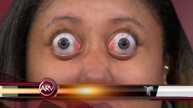 La mujer con los ojos más saltones del mundo muestra su habilidad | Al Rojo Vivo | Telemundo смотреть онлайн