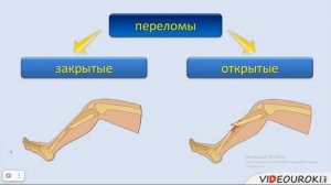 Урок 6: Первая помощь при ушибах, растяжениях, вывихов и переломах