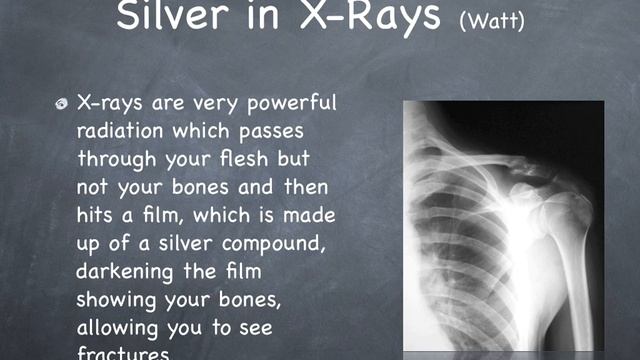 Silver (Ag) EA Visual - Vineeth Gangaram - part 2