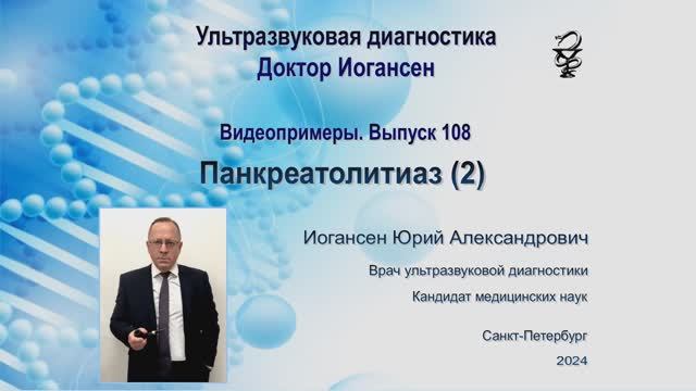 УЗИ. Доктор Иогансен. Видеопримеры. Выпуск 108. Панкреатолитиаз (2).