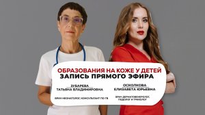 Образования на коже у детей
Совместный прямой эфир с врачом неонатологом Зубаревой Татьяной
