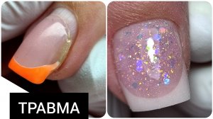 пережила ТРАВМУ ///  КОСМИЧЕСКИЙ гель