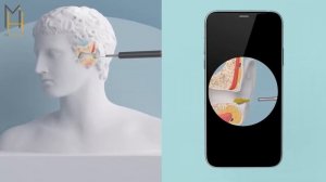 Умная ушная палочка Xiaomi Bebird Ear Picker T5