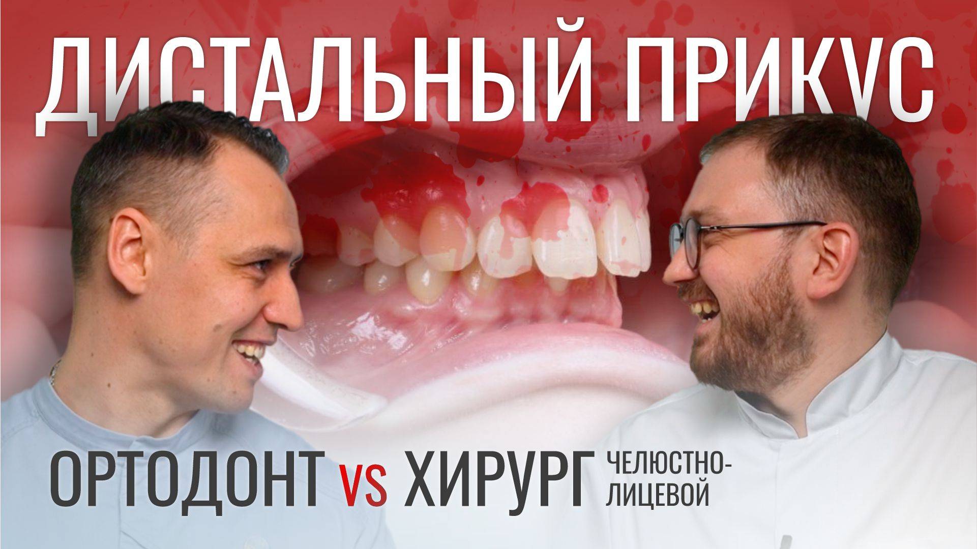 ДИСТАЛЬНЫЙ ПРИКУС. Ортодонт VS челюстно-лицевой хирург.
