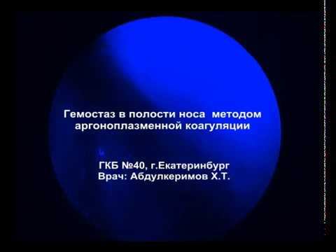 Гемостаз в полости носа методом АПК